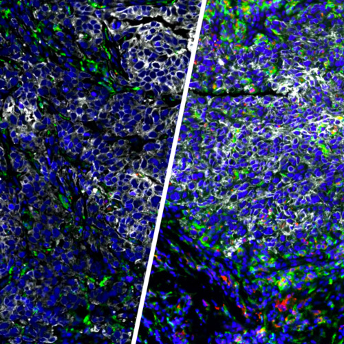 BRCA-WT-vs-BRCA1-associated-TNBC.jpg